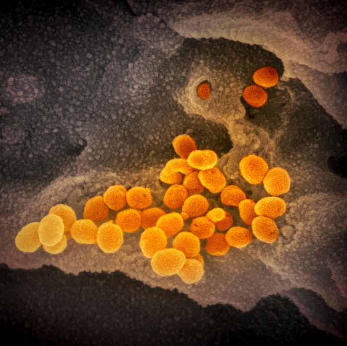 Coronavirus, l’ABC dell’infezione
