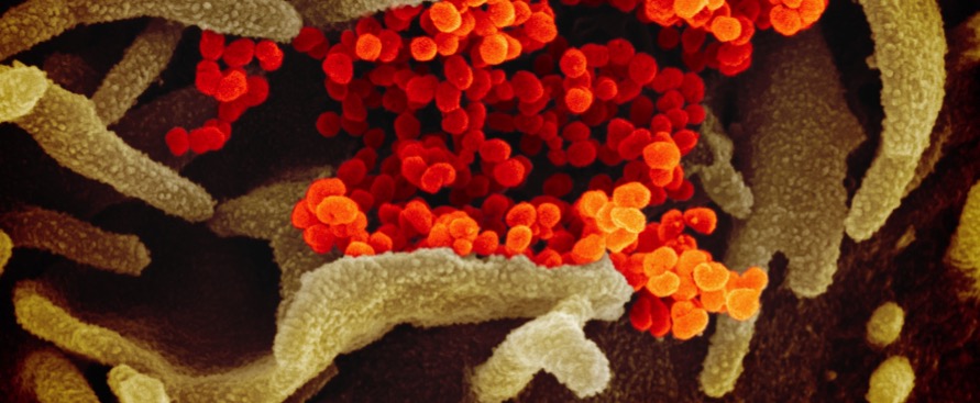 Tutte le facce del nuovo coronavirus in nuove immagini al microscopio