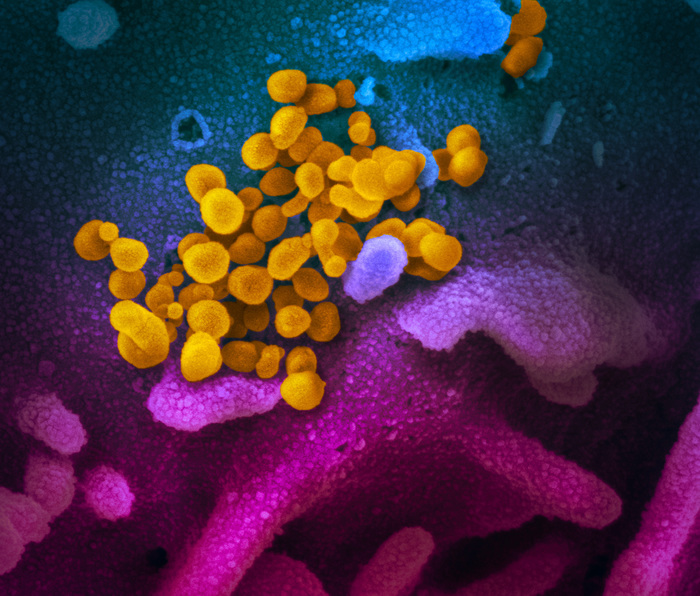 La variante Mu ‘altamente resistente’ agli anticorpi