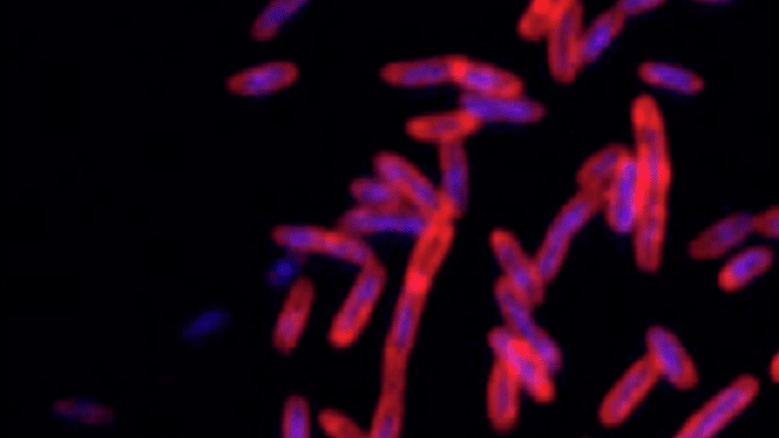 Verso un vaccino spray nasale contro le malattie respiratorie